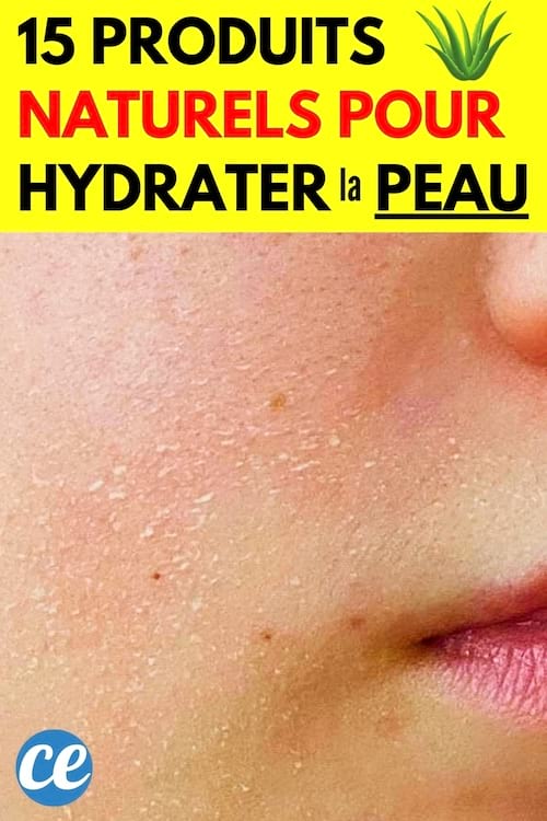 une peau sèche sur le visage qui a besoin d'être hydraté en profondeur