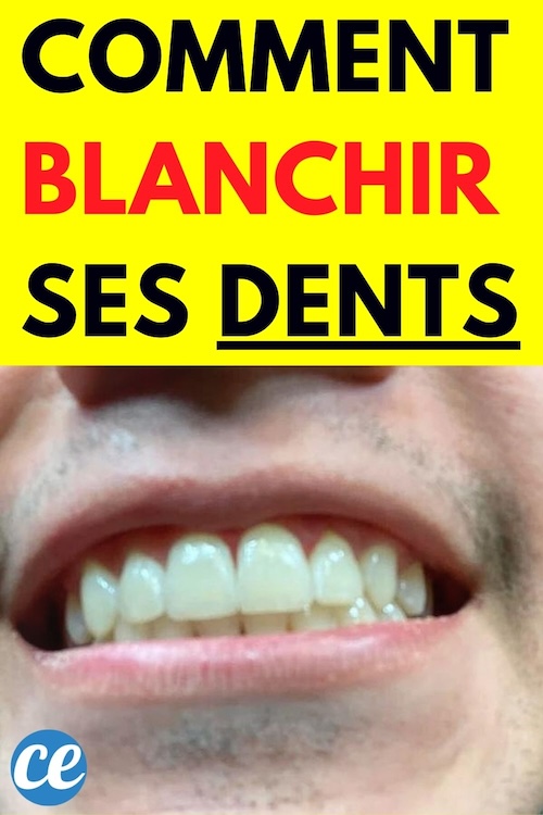 Blanchir ses Dents avec de l