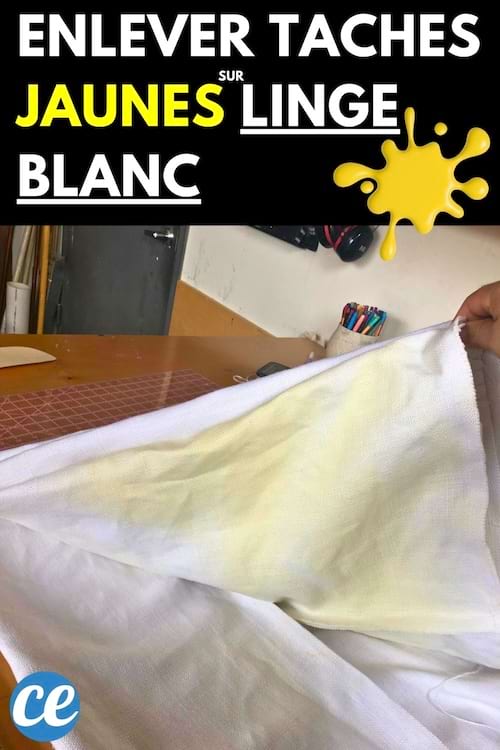 Une personne avec une main noire soulevant du linge blanc taché de jaune