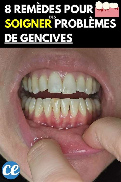 L'intérieur de la bouche d'une personne 