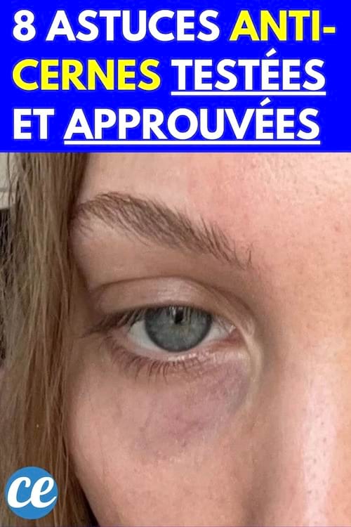 Une femme ayant des cernes