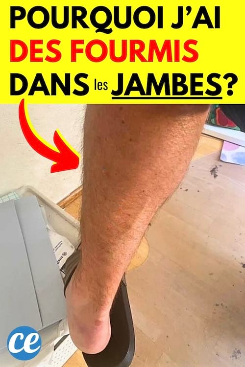 Une jambe qui a des fourmis dans les jambes