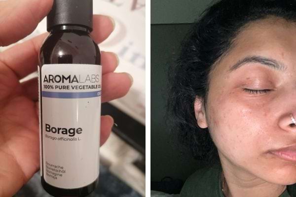 Bouteille d'huile de bourrache et visage avec imperfections.