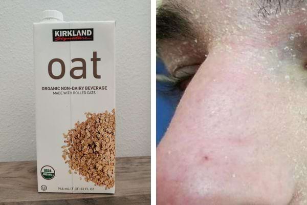 Boîte de lait d'avoine et nez sec et irrité.