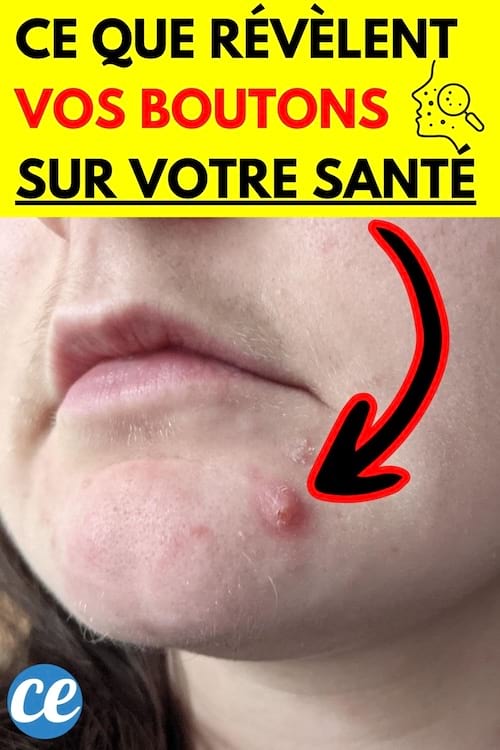 Le visage d'une femme avec un bouton rouge dessus
