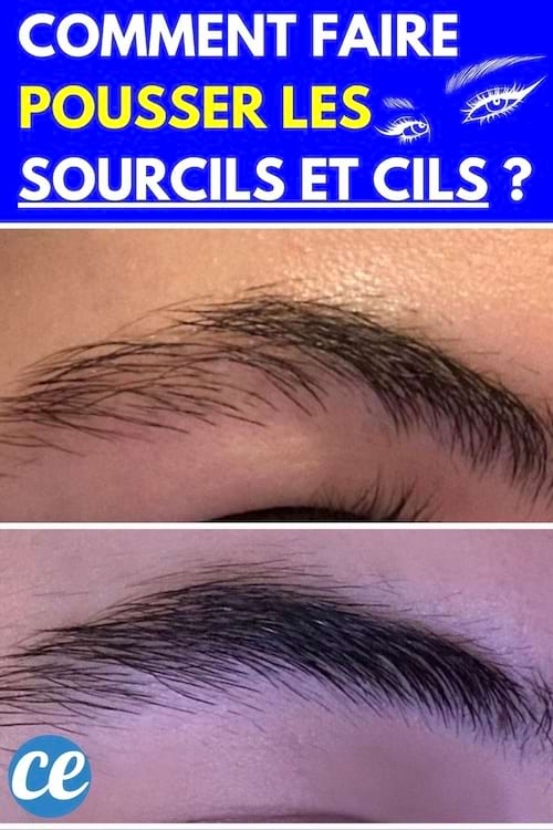 Avant/après montrant des sourcils plus fournis et épais après une routine de soins