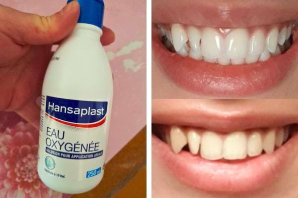 Bouteille d'eau oxyg&eacute;n&eacute;e Hansaplast pos&eacute;e &agrave; c&ocirc;t&eacute; d'un &eacute;vier rose.