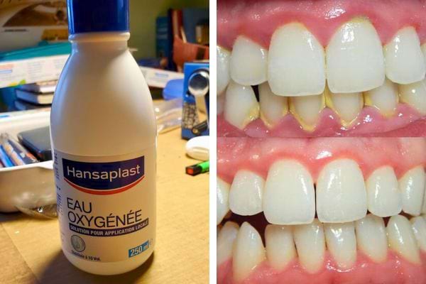 Bouteille d'eau oxyg&eacute;n&eacute;e Hansaplast sur un bureau avec des papiers.