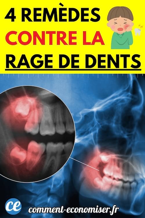 Image illustrant une radiographie dentaire d'une rage de dents