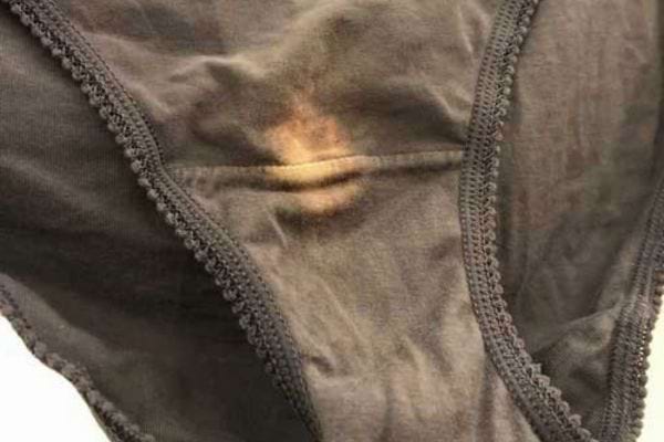 Sous-vêtements avec une tache blanche visible sur un tissu gris.