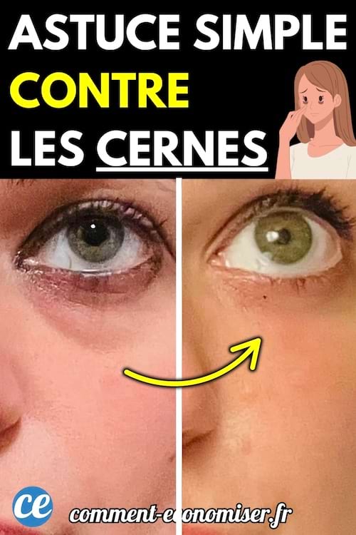 Comparaison avant/après d’un œil avec et sans cernes.