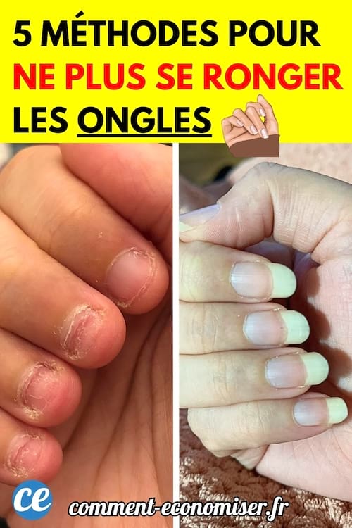 Comparaison avant/après d’ongles rongés et d’ongles longs et soignés.