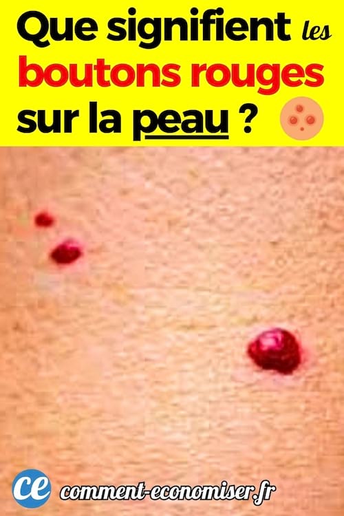 Des petits boutons rouges sur la peau et leur signification