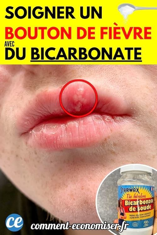 Des lèvres avec un bouton de fièvre rouge et enflé.