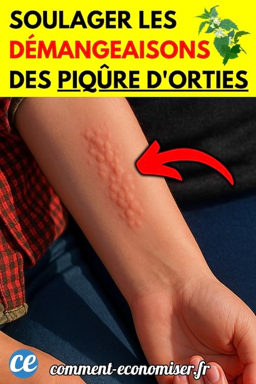  L’avant-bras d’une personne avec plusieurs traces rouges en relief, typiques d’une piqûre d’ortie.