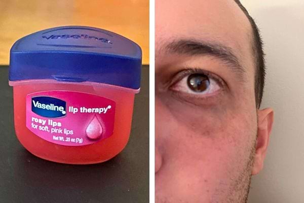 Vaseline rosy lips et cerne foncé sur visage masculin.