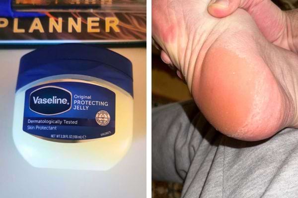 Talon sec comparé à un pot de vaseline protectrice.