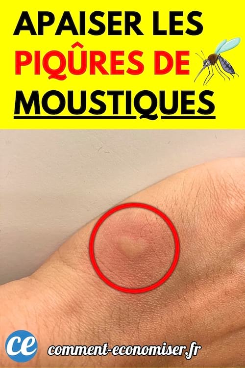 Main avec une piqûre de moustique enflée encerclée en rouge