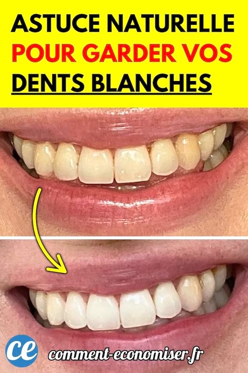Comparatif avant/après d’un sourire montrant des dents jaunies puis blanchies.