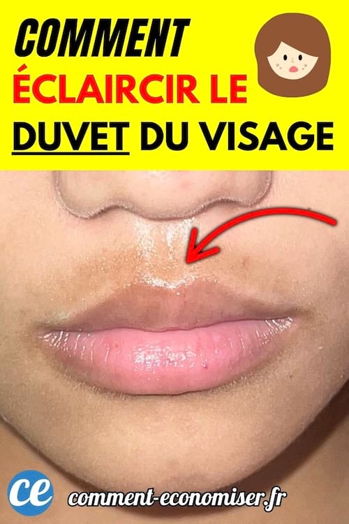 Gros plan sur la zone de la lèvre supérieure d’un visage féminin avec du duvet visible.