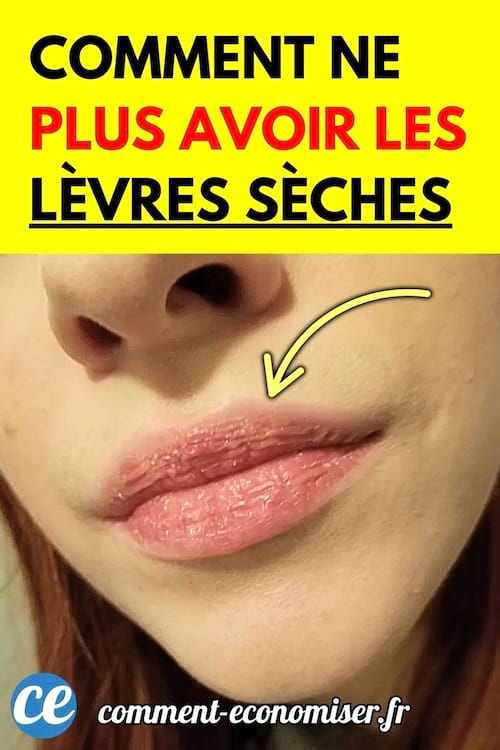 Gros plan sur des lèvres gercées légèrement fendillées sur le visage d’une femme.