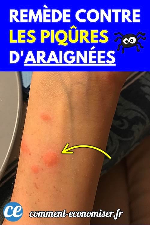 Bras avec trois piqûres rouges d’araignée entourées d’une flèche jaune