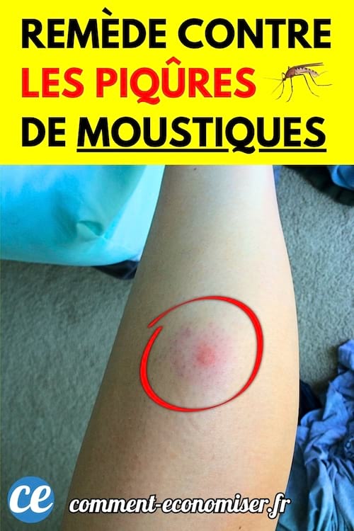 Un bras avec une piqûre de moustique encerclée en rouge, sur fond de lit et de couverture bleue.