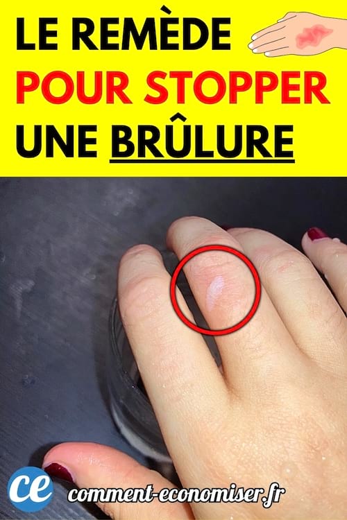 Doigt avec cloque de brûlure encerclée en rouge sous un filet d’eau froide