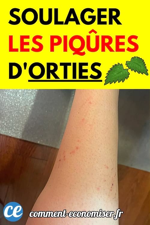 Bras avec des piqûres rouges causées par des orties.