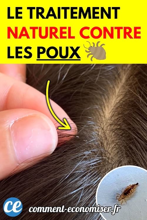 Un cuir chevelu avec une main écartant les cheveux pour montrer un pou.