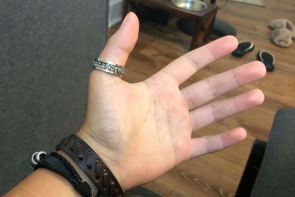 Grosse bague argentée portée au pouce droit.