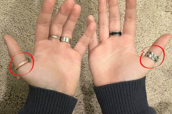 Deux mains avec plusieurs bagues, pouce cerclé en rouge.