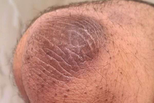 Coude très foncé, sec et marqué de plis profonds.