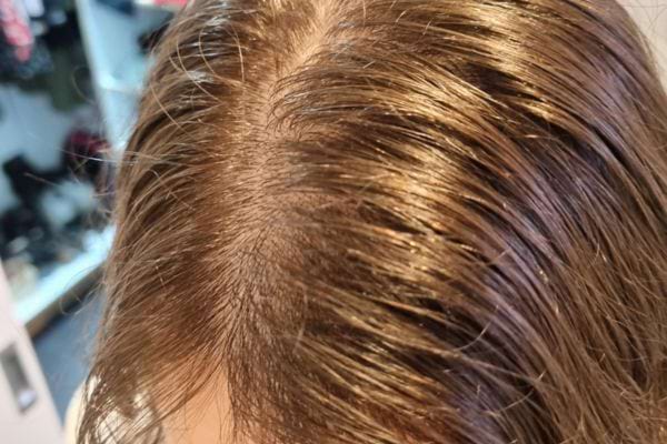 Racines grasses et brillantes après plusieurs jours sans lavage.