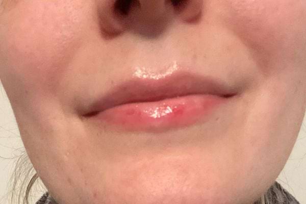 Lèvres brillantes avec rougeur, protégées par de la Vaseline.