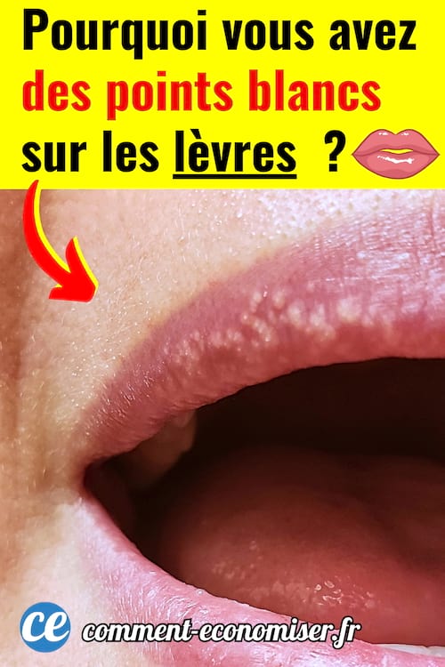 Des points blancs qui apparaissent sur les lèvres d'une femme