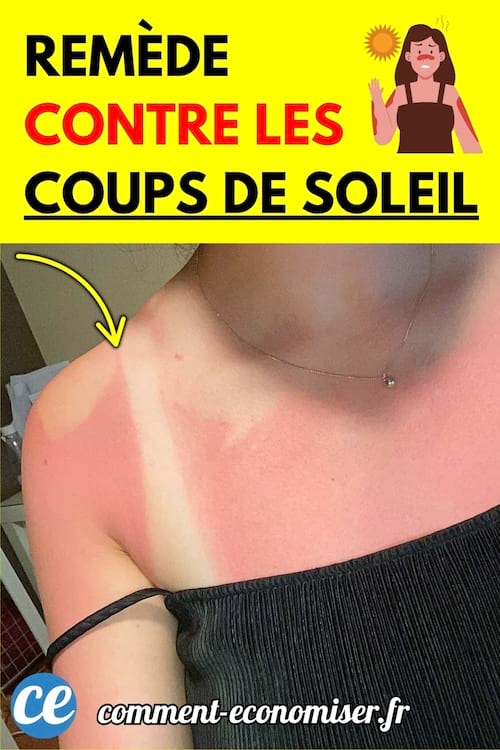Épaule et haut du torse d'une femme avec un fort coup de soleil laissant une marque de bretelle blanche.