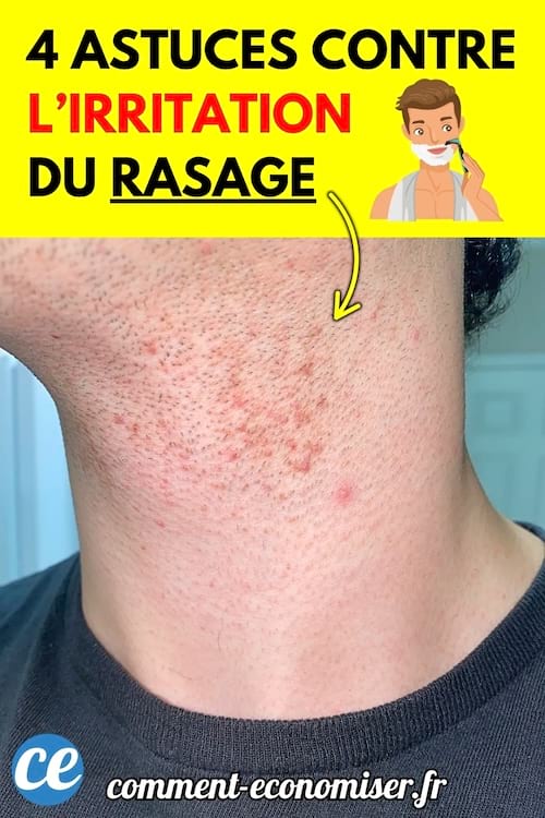 Peau du cou d’un homme présentant des rougeurs et des irritations dues au rasage.