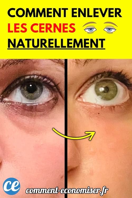 Comparaison entre deux yeux : l’un avec des cernes visibles, l’autre avec un contour des yeux net. 