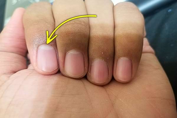 Doigt avec demi-lune blanche visible, indiquée par une flèche jaune.