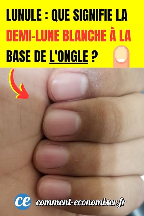 des ongles avec des demi-lunes blanches et d'autres sans lunule