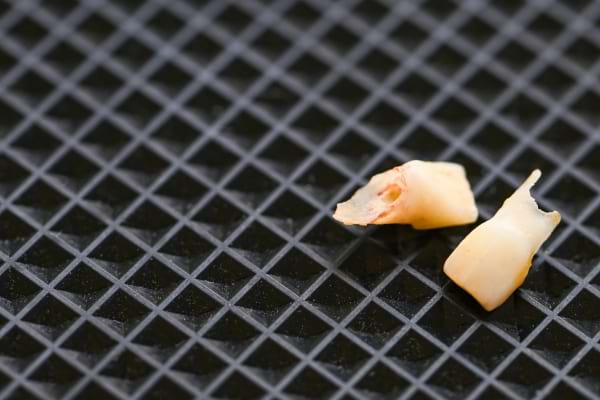 Deux dents cassées posées sur une surface noire quadrillée.