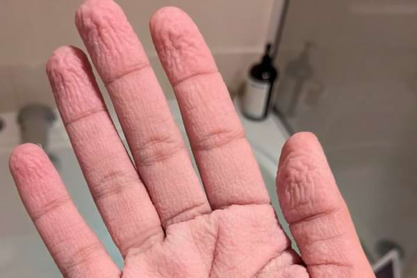 Main ridée en gros plan avec des plis bien marqués sur les doigts.