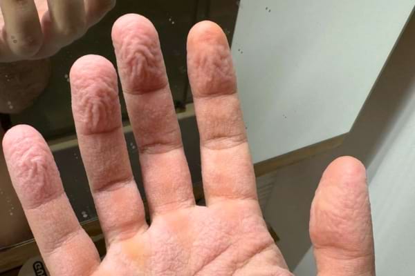 Une autre main ridée est observée devant un miroir, doigts bien visibles.