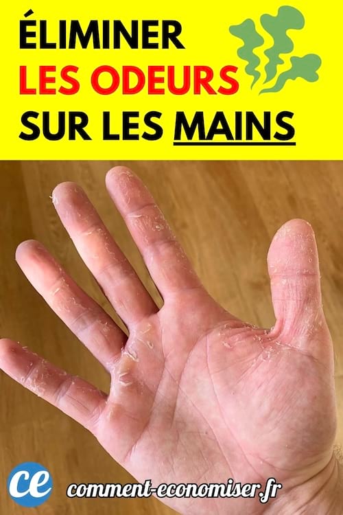 Une main ouverte montrant des traces de résidus ou de produits sur la peau.