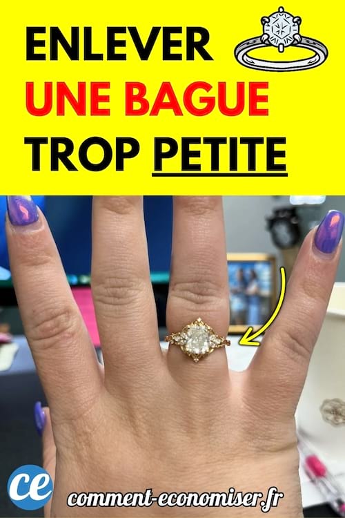 Main avec une bague sertie d’un gros diamant coincée au niveau de l’articulation du doigt.