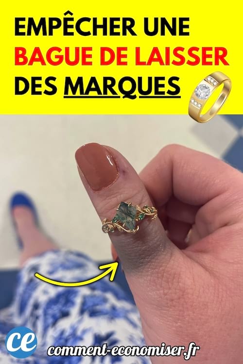 Une main tenant une bague dorée avec une pierre, montrant une marque laissée sur le doigt.