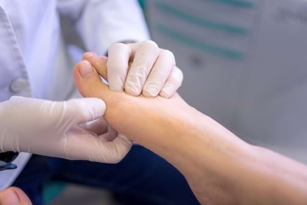 Un professionnel examine un orteil pour détecter une anomalie.
