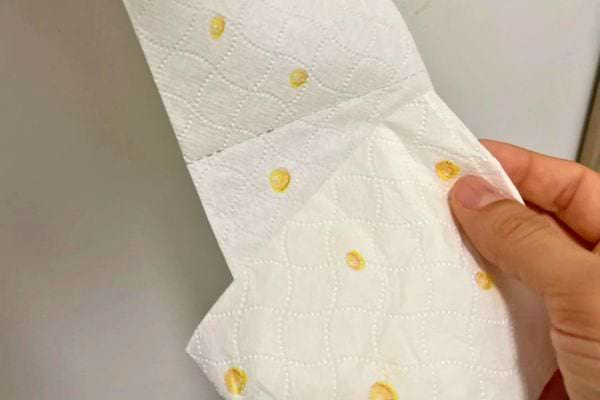 Papier toilette blanc avec des taches jaunes visibles.