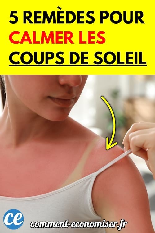 Une femme en débardeur blanc avec un coup de soleil rouge vif sur l’épaule.
